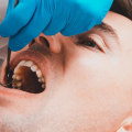 Exploring Dental Coverage Options for Pflugerville Residents