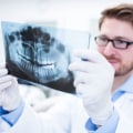 Understanding In-Network vs. Out-of-Network Dental Coverage in Pflugerville, Texas