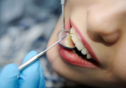 Identifying Your Dental Needs: Understanding Dental Coverage in Pflugerville, Texas